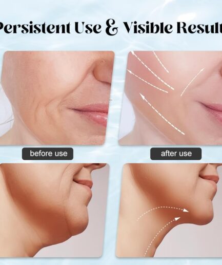 Massager for Face Lifting Facial Massagers EMS Neck Eye Massage Instrument Vibrator Microcurrents Red Light Therapy Anti Wrinkle - Random Color